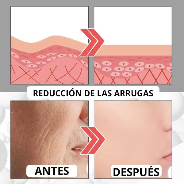 Botox UP | Serum Antiedad 